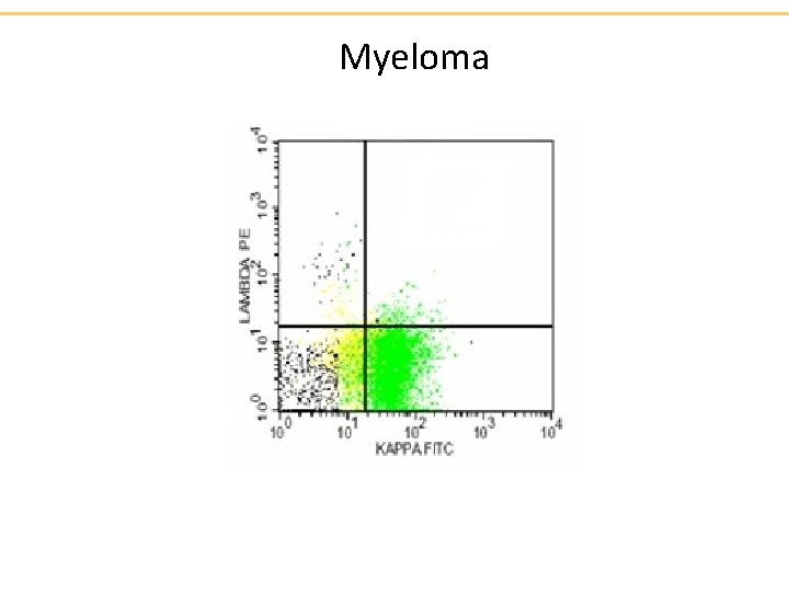 Myeloma 