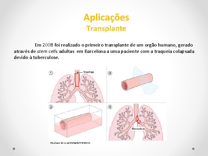 Aplicações Transplante Em 2008 foi realizado o primeiro transplante de um orgão humano, gerado