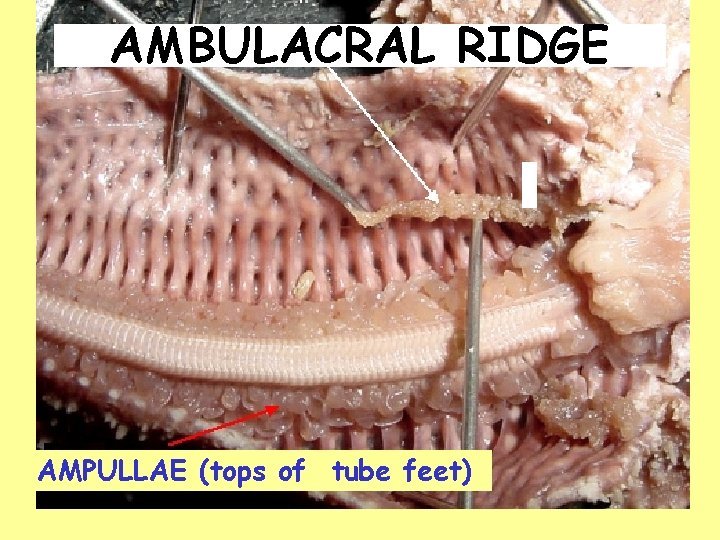AMBULACRAL RIDGE AMPULLAE (tops of tube feet) 