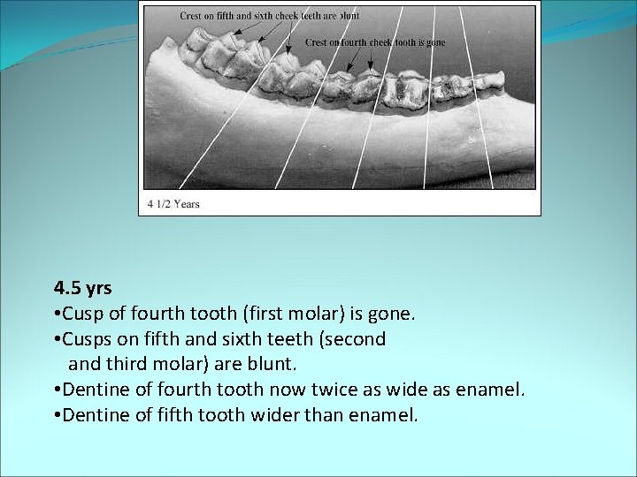 4. 5 yrs • Cusp of fourth tooth (first molar) is gone. • Cusps