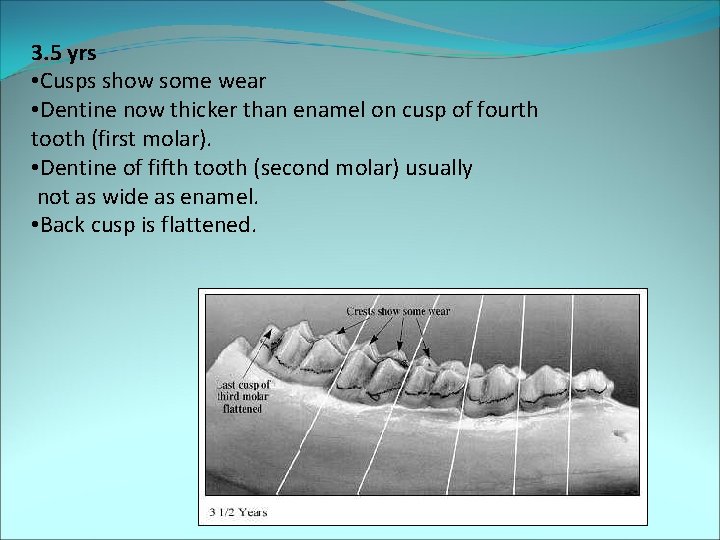 3. 5 yrs • Cusps show some wear • Dentine now thicker than enamel