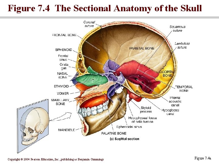 Figure 7. 4 The Sectional Anatomy of the Skull Copyright © 2004 Pearson Education,