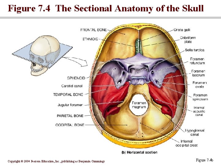 Figure 7. 4 The Sectional Anatomy of the Skull Copyright © 2004 Pearson Education,