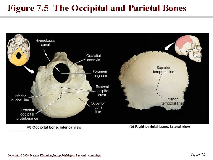 Figure 7. 5 The Occipital and Parietal Bones Copyright © 2004 Pearson Education, Inc.