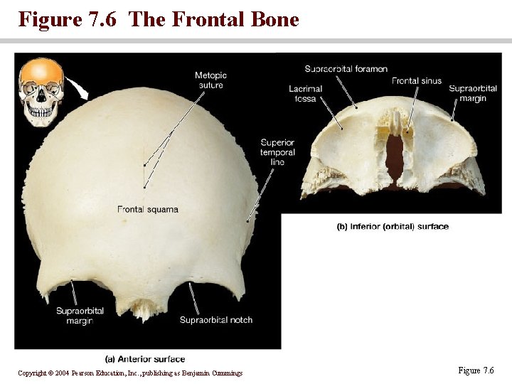 Figure 7. 6 The Frontal Bone Copyright © 2004 Pearson Education, Inc. , publishing