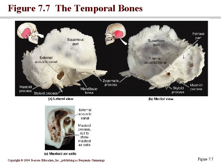 Figure 7. 7 The Temporal Bones Copyright © 2004 Pearson Education, Inc. , publishing