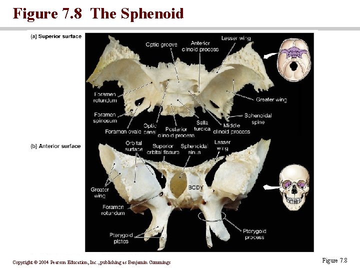 Figure 7. 8 The Sphenoid Copyright © 2004 Pearson Education, Inc. , publishing as