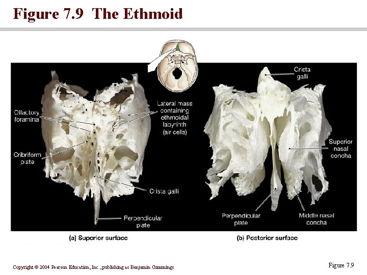 Figure 7. 9 The Ethmoid Copyright © 2004 Pearson Education, Inc. , publishing as