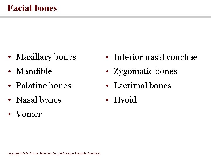 Facial bones • Maxillary bones • Inferior nasal conchae • Mandible • Zygomatic bones