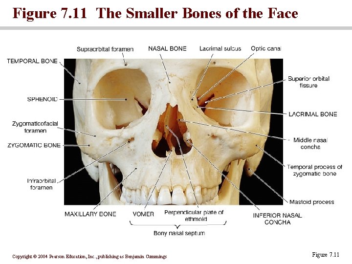 Figure 7. 11 The Smaller Bones of the Face Copyright © 2004 Pearson Education,