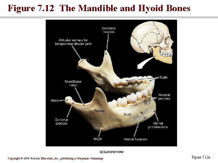 Figure 7. 12 The Mandible and Hyoid Bones Copyright © 2004 Pearson Education, Inc.
