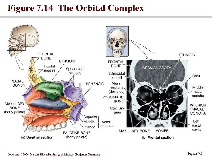 Figure 7. 14 The Orbital Complex Copyright © 2004 Pearson Education, Inc. , publishing