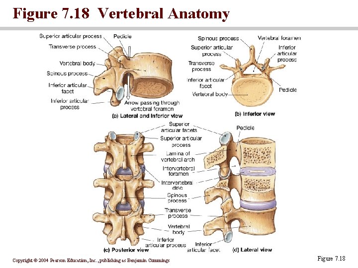 Figure 7. 18 Vertebral Anatomy Copyright © 2004 Pearson Education, Inc. , publishing as