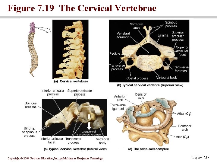 Figure 7. 19 The Cervical Vertebrae Copyright © 2004 Pearson Education, Inc. , publishing