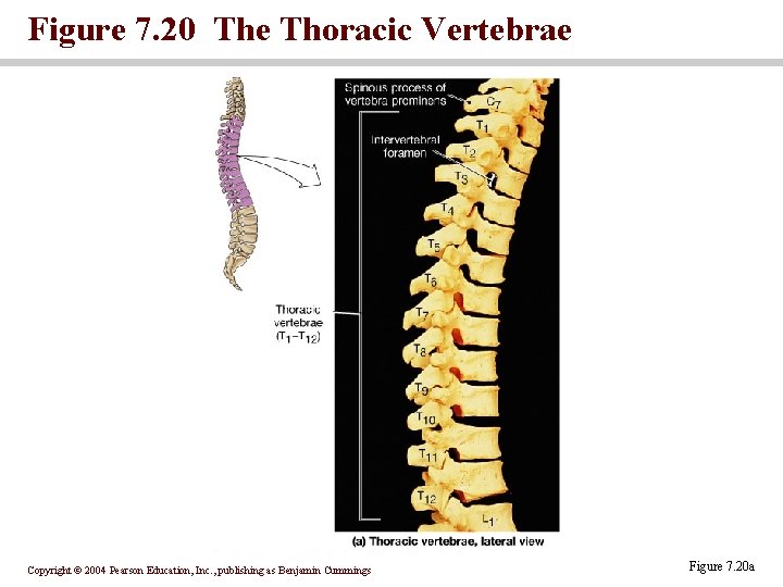 Figure 7. 20 The Thoracic Vertebrae Copyright © 2004 Pearson Education, Inc. , publishing