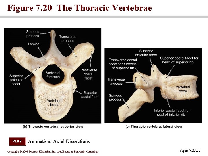 Figure 7. 20 The Thoracic Vertebrae PLAY Animation: Axial Dissections Copyright © 2004 Pearson