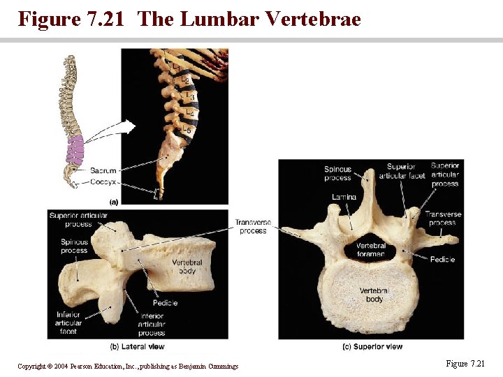 Figure 7. 21 The Lumbar Vertebrae Copyright © 2004 Pearson Education, Inc. , publishing