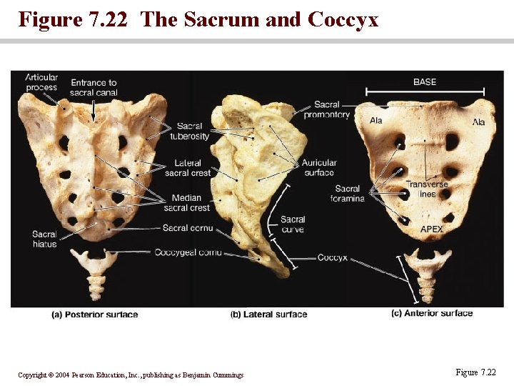 Figure 7. 22 The Sacrum and Coccyx Copyright © 2004 Pearson Education, Inc. ,