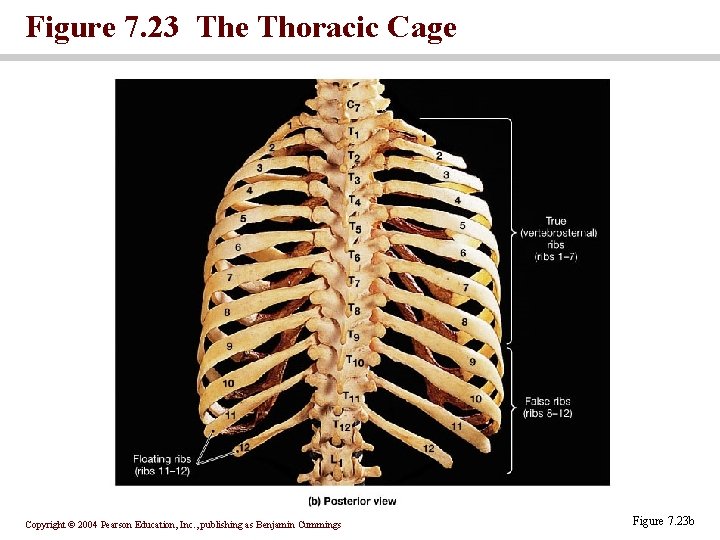 Figure 7. 23 The Thoracic Cage Copyright © 2004 Pearson Education, Inc. , publishing