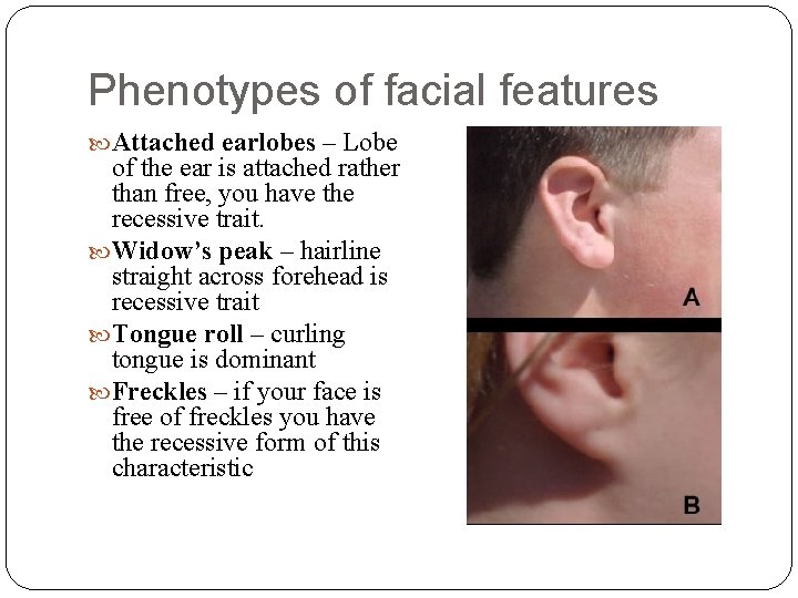 Phenotypes of facial features Attached earlobes – Lobe of the ear is attached rather