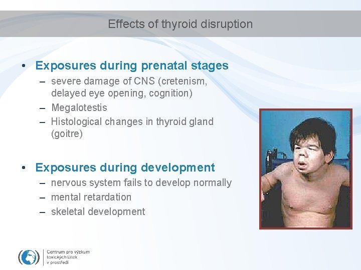 Effects of thyroid disruption • Exposures during prenatal stages – severe damage of CNS