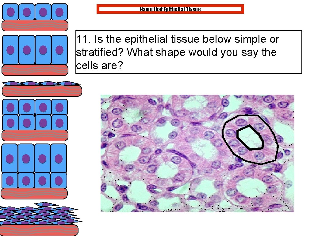 Name that Epithelial Tissue 11. Is the epithelial tissue below simple or stratified? What