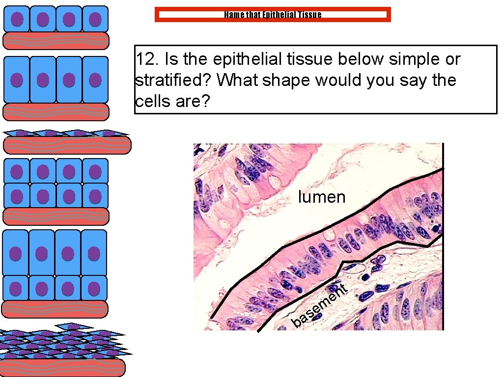 Name that Epithelial Tissue 12. Is the epithelial tissue below simple or stratified? What Name that Epithelial Tissue 12. Is the epithelial tissue below simple or stratified? What
