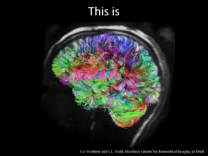 This is V. J. Wedeen and L. L. Wald, Martinos Center for Biomedical Imaging