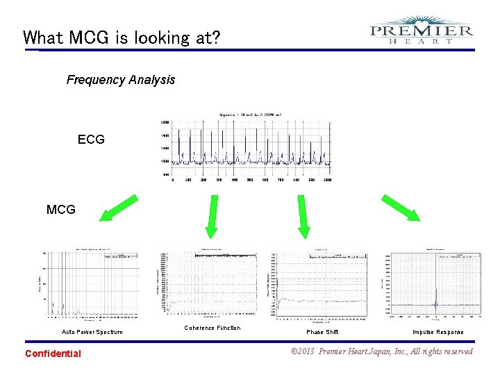 What MCG is looking at? Frequency Analysis ECG MCG Auto Power Spectrum Confidential Coherence