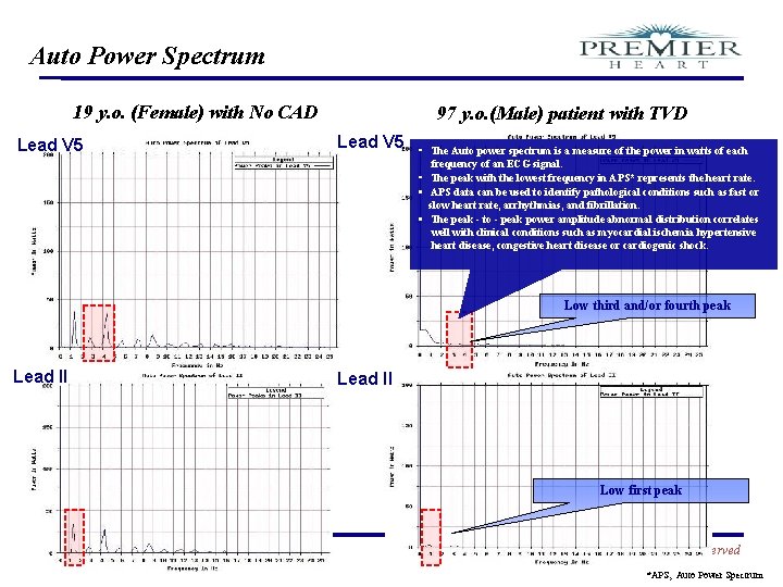 Auto Power Spectrum 19 y. o. (Female) with No CAD Lead V 5 97