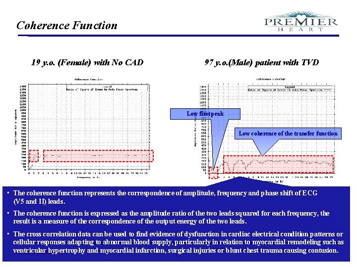 Coherence Function 19 y. o. (Female) with No CAD 97 y. o. (Male) patient
