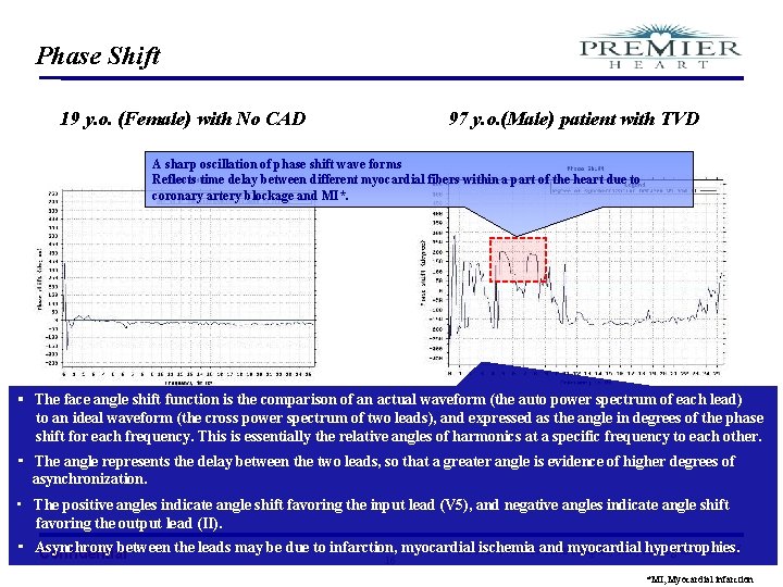 Phase Shift 19 y. o. (Female) with No CAD 97 y. o. (Male) patient
