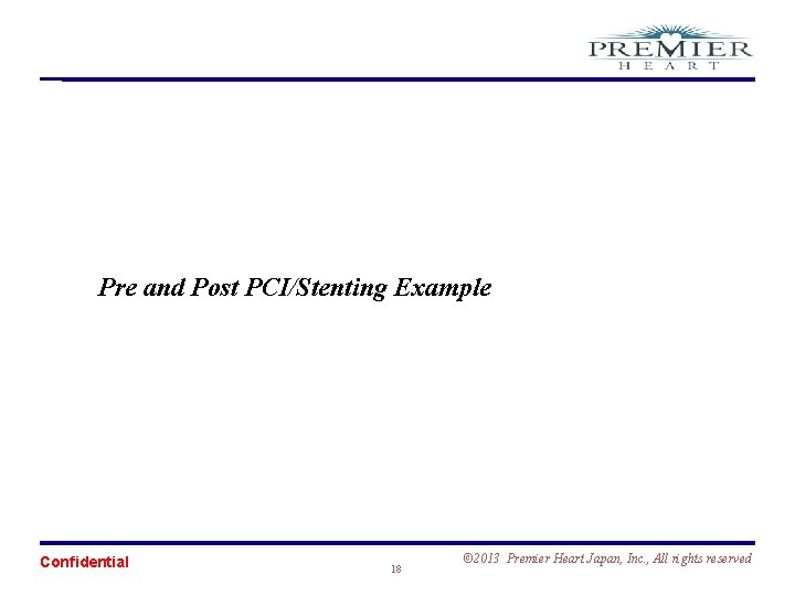 Pre and Post PCI/Stenting Example Confidential 18 © 2013 Premier Heart Japan, Inc. ,