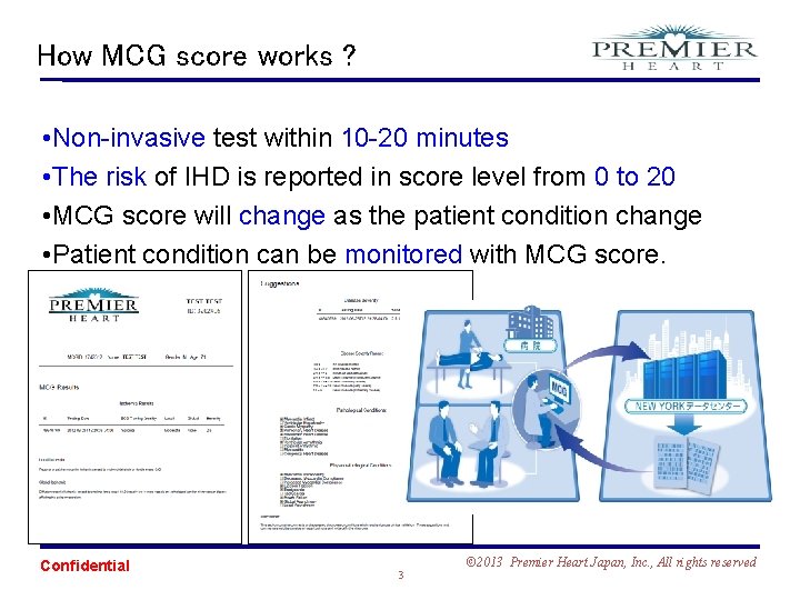 How MCG score works ? • Non-invasive test within 10 -20 minutes • The