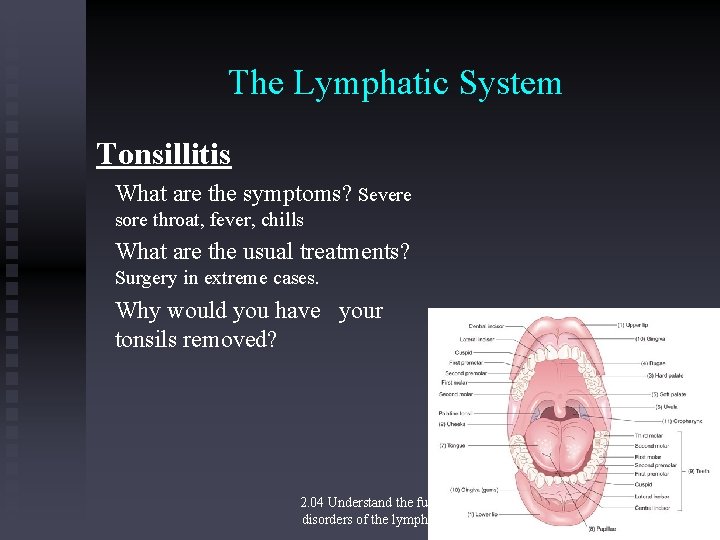 The Lymphatic System Tonsillitis What are the symptoms? Severe sore throat, fever, chills What