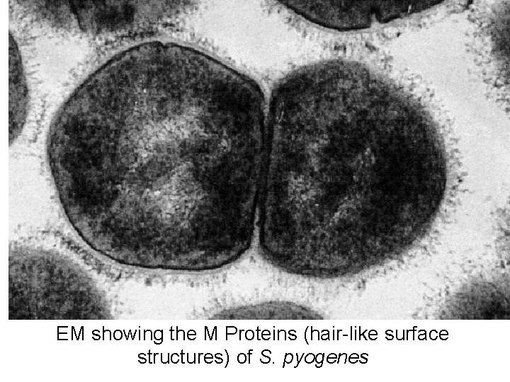 EM showing the M Proteins (hair-like surface structures) of S. pyogenes 