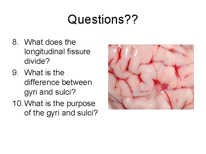 Questions? ? 8. What does the longitudinal fissure divide? 9. What is the difference