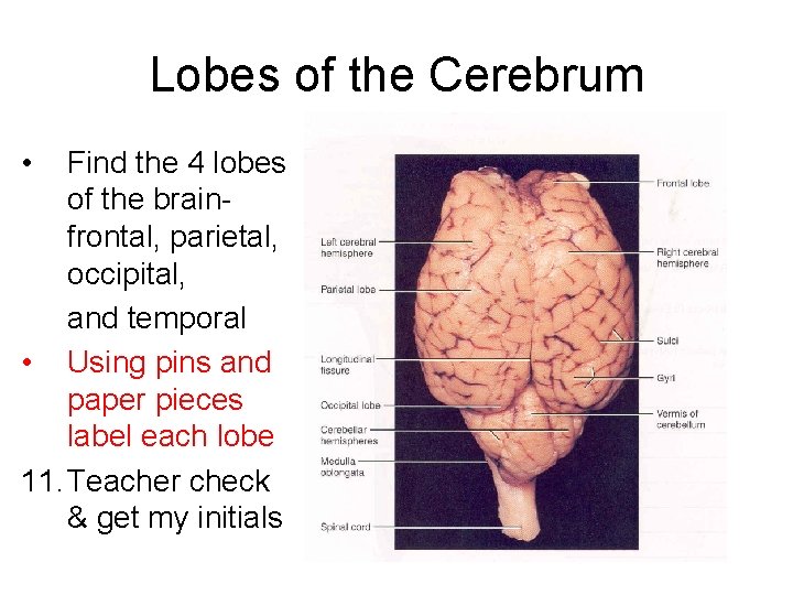 Lobes of the Cerebrum • Find the 4 lobes of the brainfrontal, parietal, occipital,