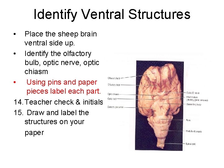 Identify Ventral Structures • Place the sheep brain ventral side up. • Identify the