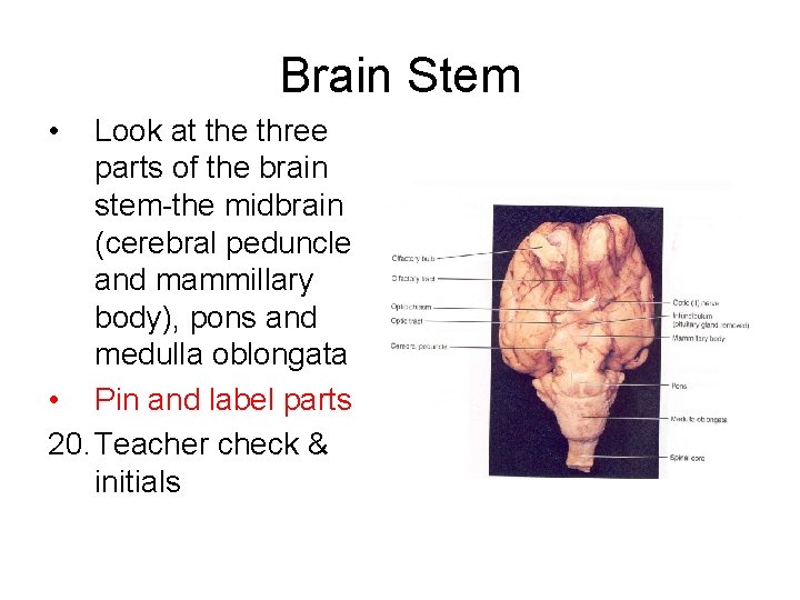 Brain Stem • Look at the three parts of the brain stem-the midbrain (cerebral