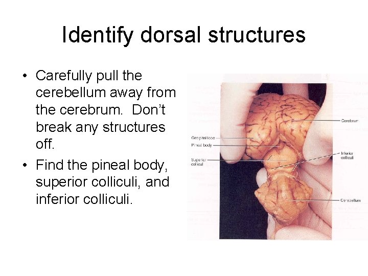 Identify dorsal structures • Carefully pull the cerebellum away from the cerebrum. Don’t break