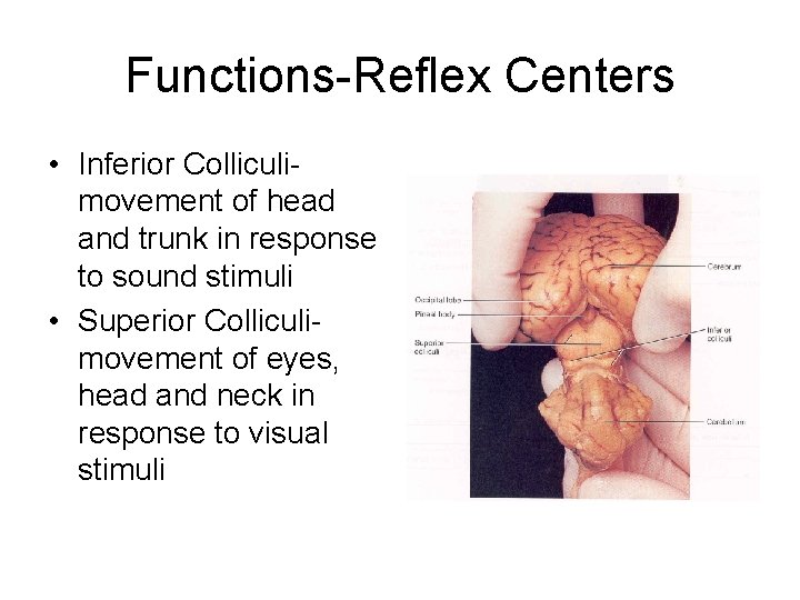 Functions-Reflex Centers • Inferior Colliculimovement of head and trunk in response to sound stimuli