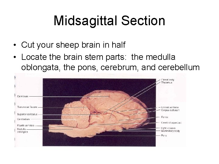 Midsagittal Section • Cut your sheep brain in half • Locate the brain stem