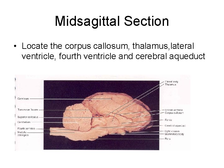 Midsagittal Section • Locate the corpus callosum, thalamus, lateral ventricle, fourth ventricle and cerebral