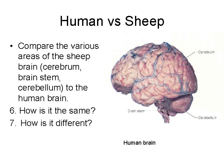 Human vs Sheep • Compare the various areas of the sheep brain (cerebrum, brain