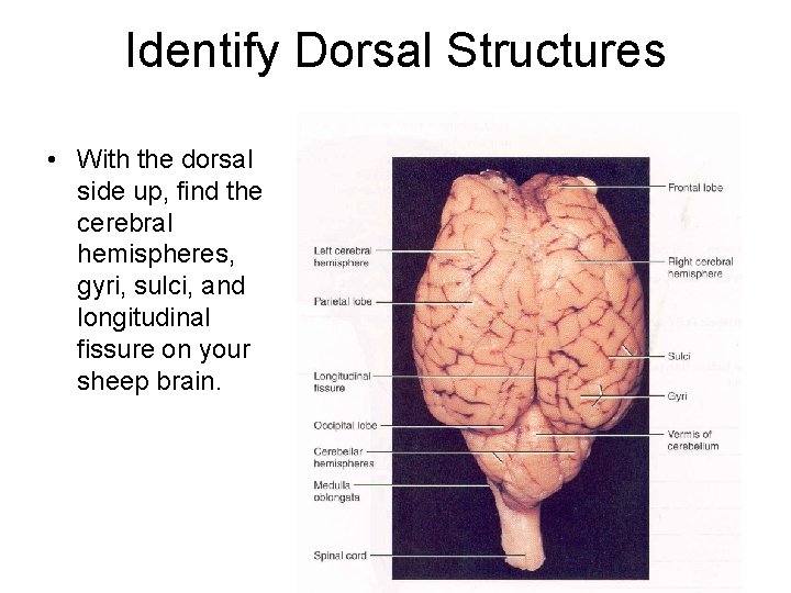 Identify Dorsal Structures • With the dorsal side up, find the cerebral hemispheres, gyri,