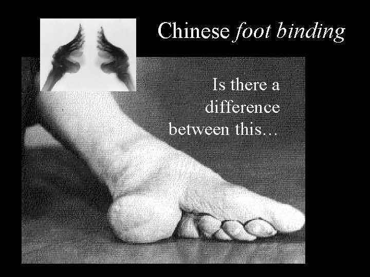 Chinese foot binding Is there a difference between this… 