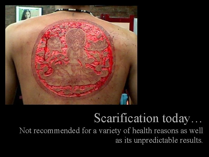 Scarification today… Not recommended for a variety of health reasons as well as its