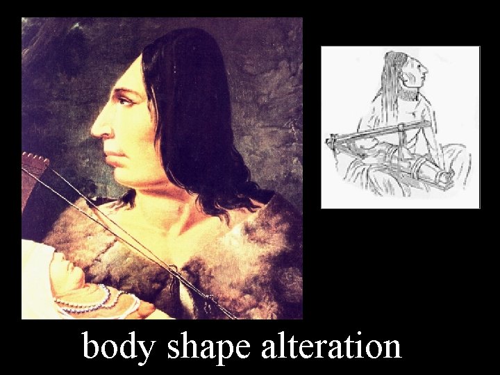 body shape alteration 