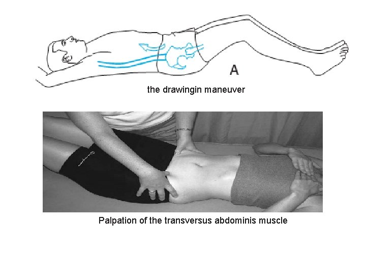 the drawingin maneuver Palpation of the transversus abdominis muscle 